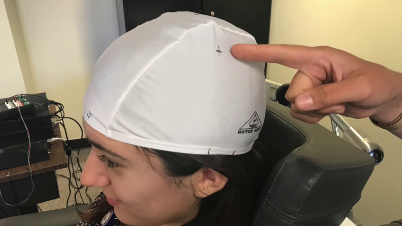 Transcranial Magnetic Stimulation (TMS)-Finding Resting Motor Threshold