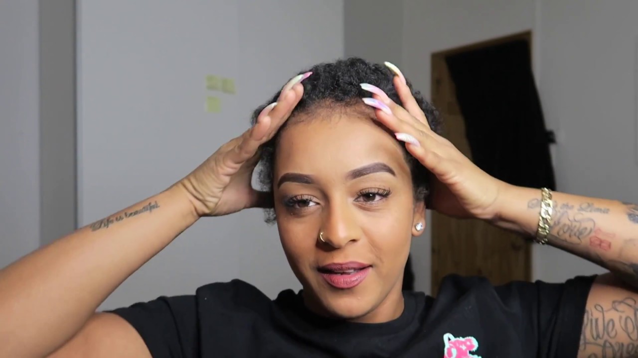 Hair Vlog #4 | 17 Weeks Since My Hair Transplant