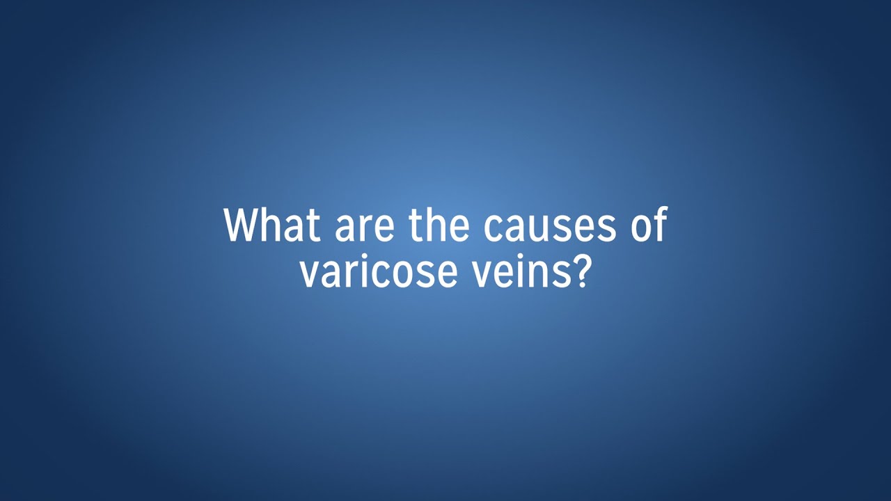 Causes of Varicose Veins?