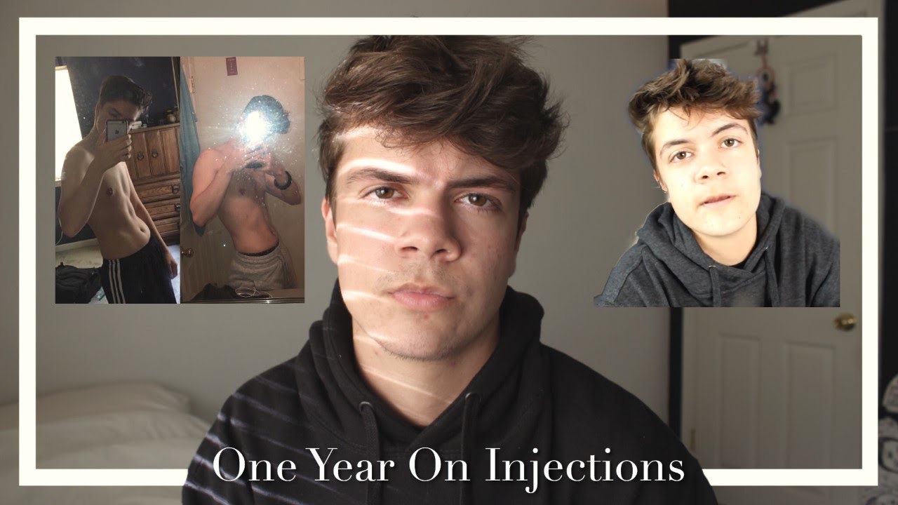 FtM One Year On Hormones