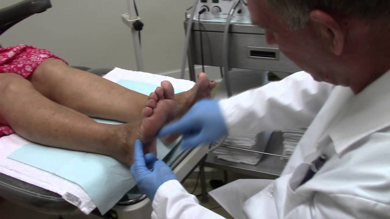 Heel Pain Treatment - Wilson Foot Clinic - Burlington Ontario