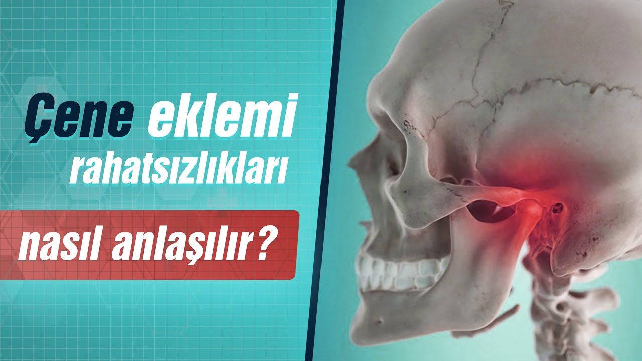 Çene eklemı̇ rahatsızlıkları nasıl anlaşılır?