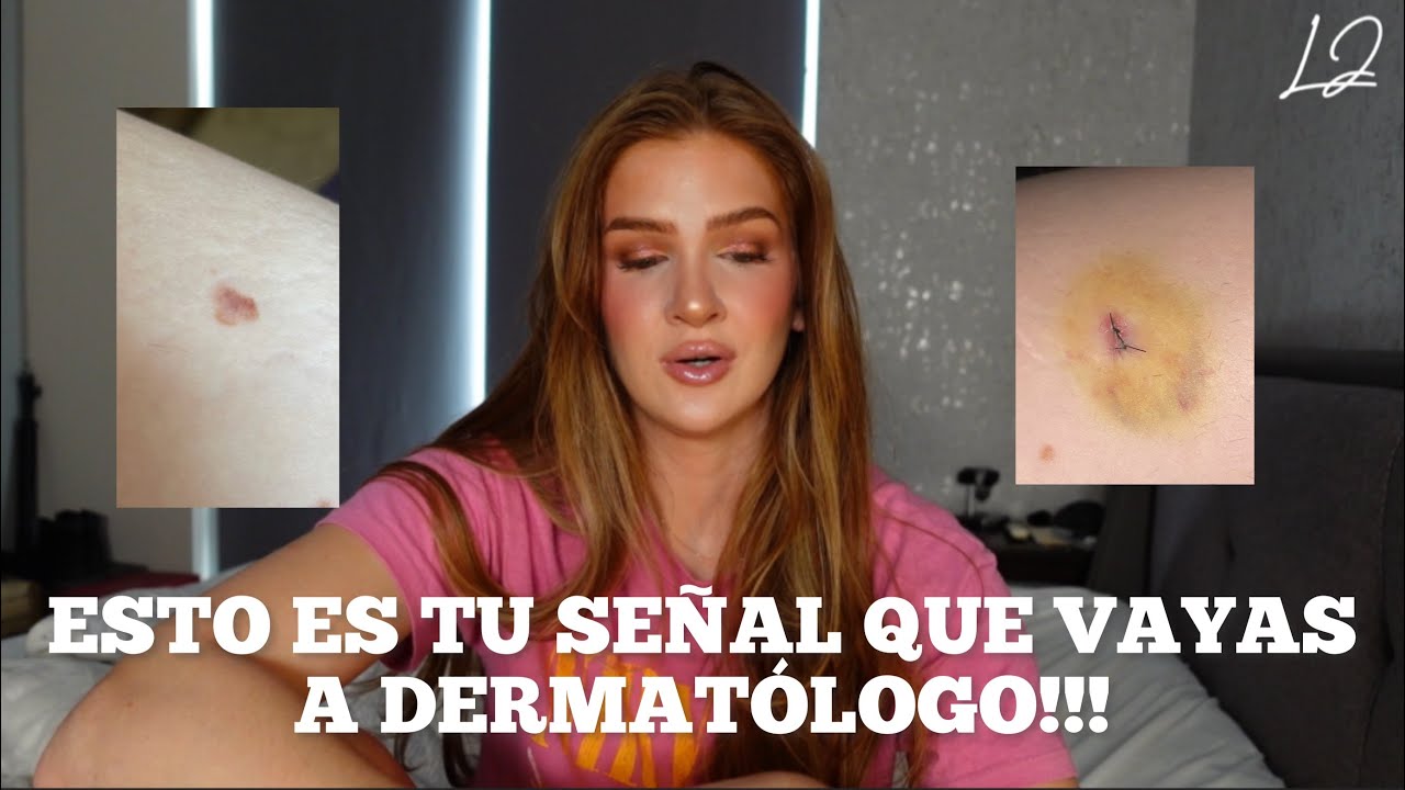 Me hicieron una biopsia…🥵 