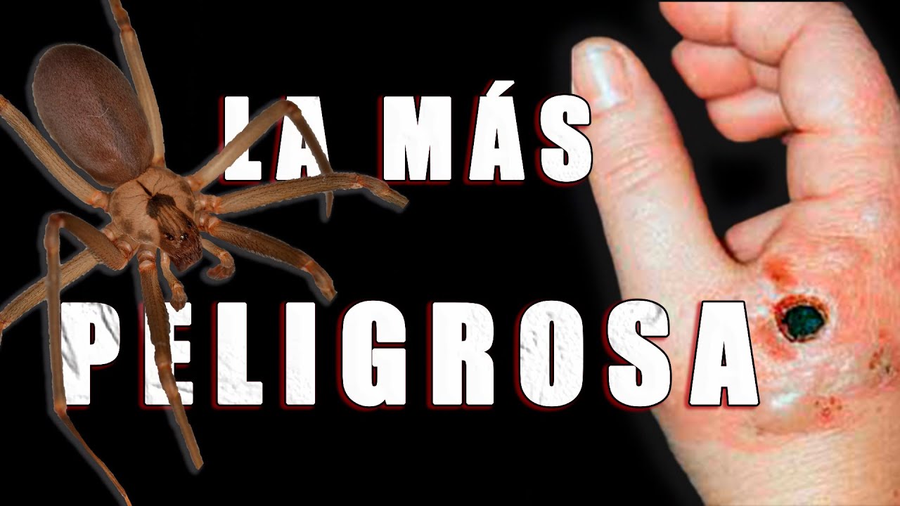 La ara&ntilde;a m&aacute;s peligrosa de Espa&ntilde;a, ara&ntilde;a Violinista ,ara&ntilde;a Reclusa,ara&ntilde;a de Rinc&oacute;n| (Loxosceles sp.)