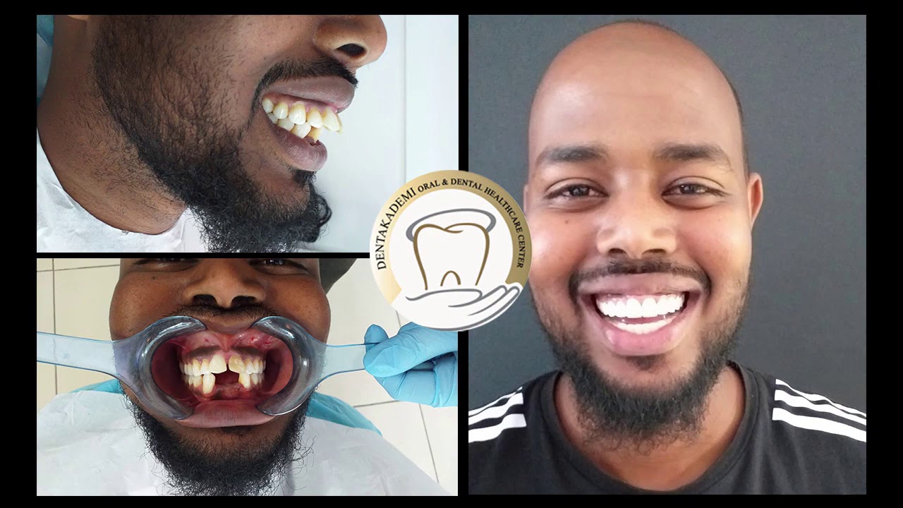 Jamac Abdinuur, Dentakademi Oral and Dental Healthcare Center, Istanbul