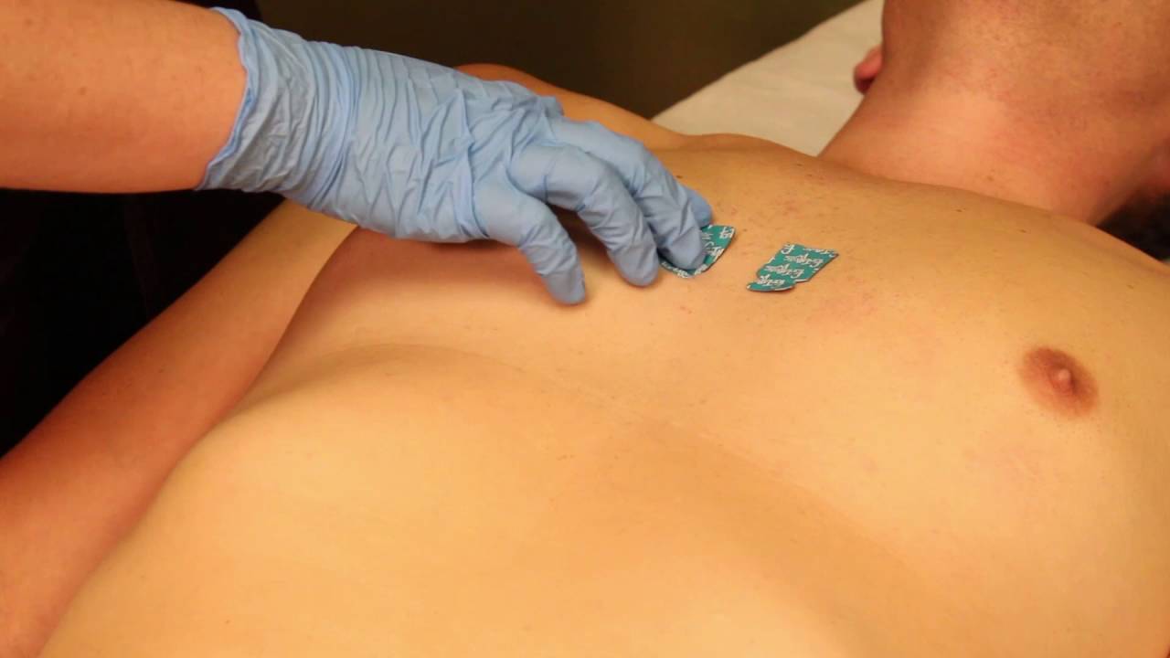 RX Tennessee Reverse ECG Placement mp4