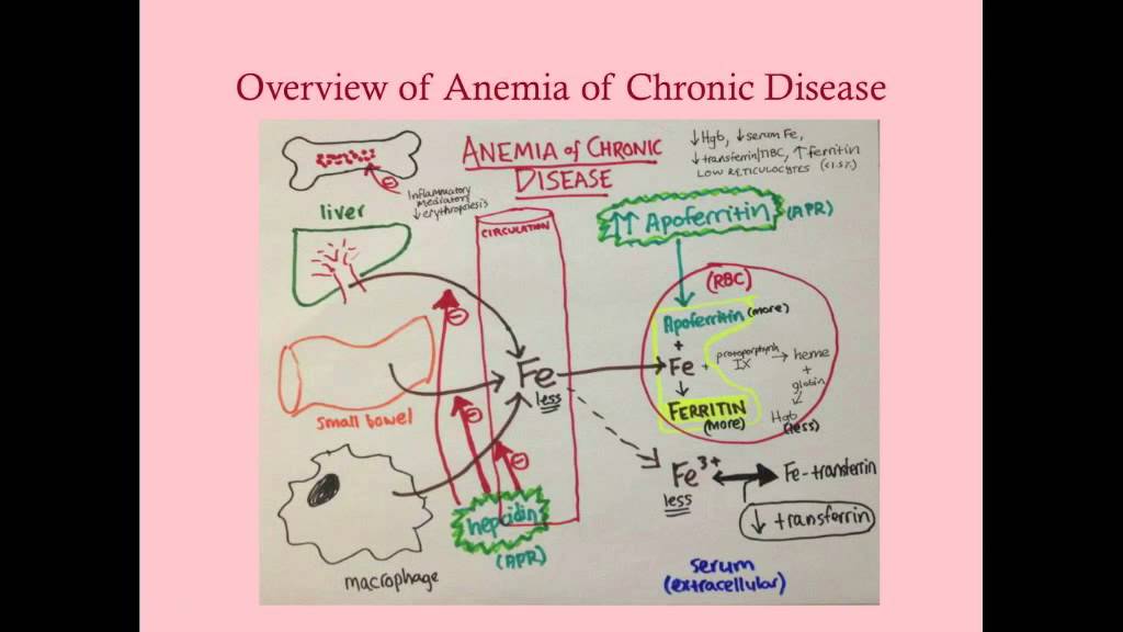 Anemia of Chronic Disease - CRASH! Medical Review Series