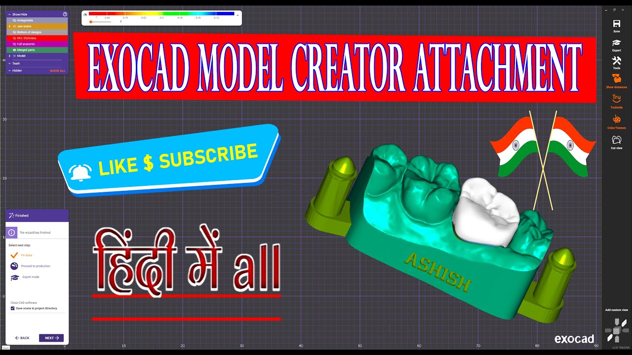 exocad model creator attachment  || How to Easily model creator and attachment 🦷