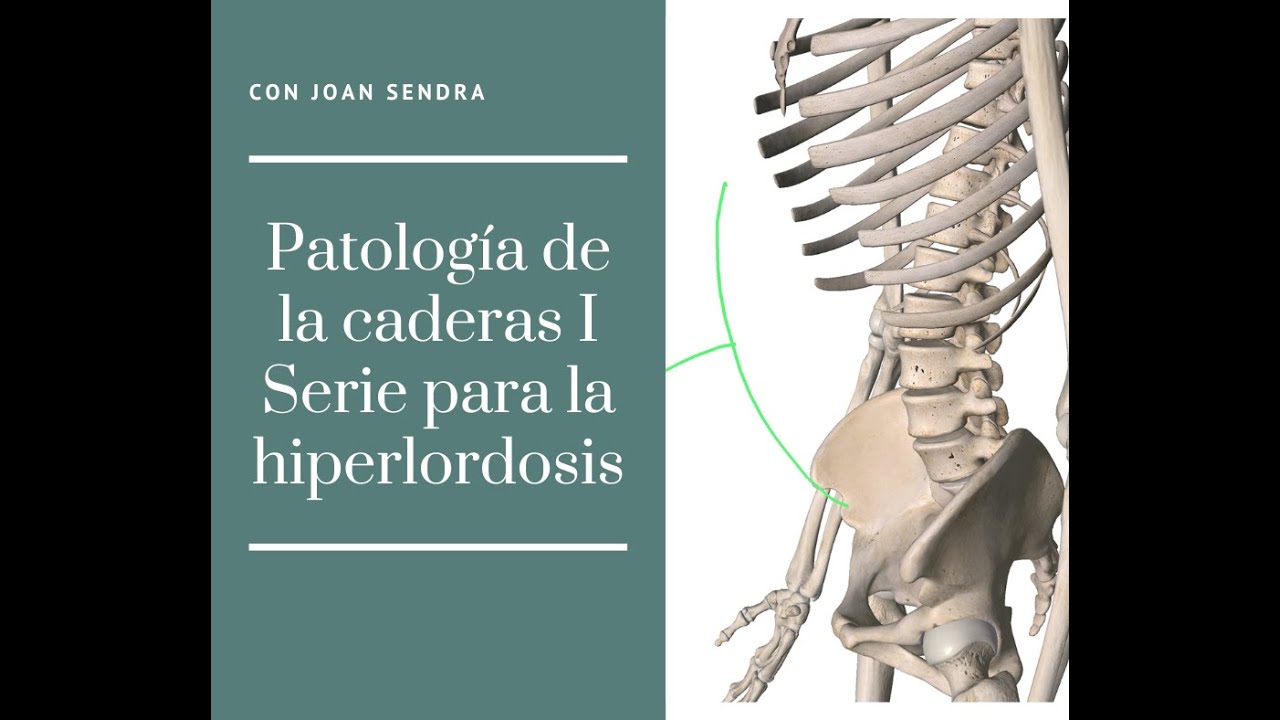 Patología de la cadera I - Hiperlordosis
