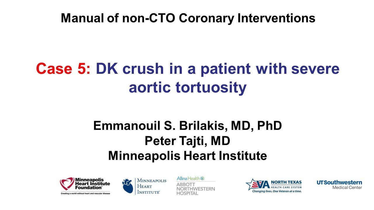 Case 5: PCI Manual - Aortic Tortuosity and DK crush