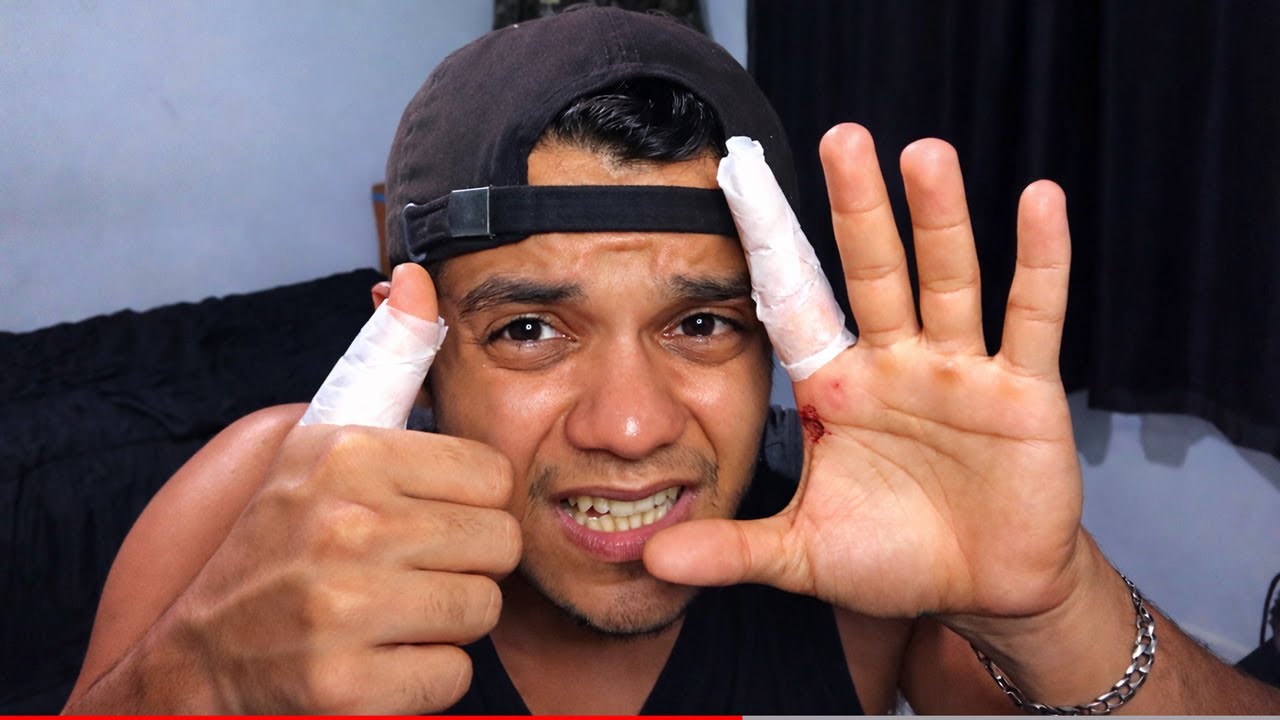 FUI M0RD1D0 POR UM CACHORRO E NÃO CONSIGO MAIS JOGAR FREE FIRE...