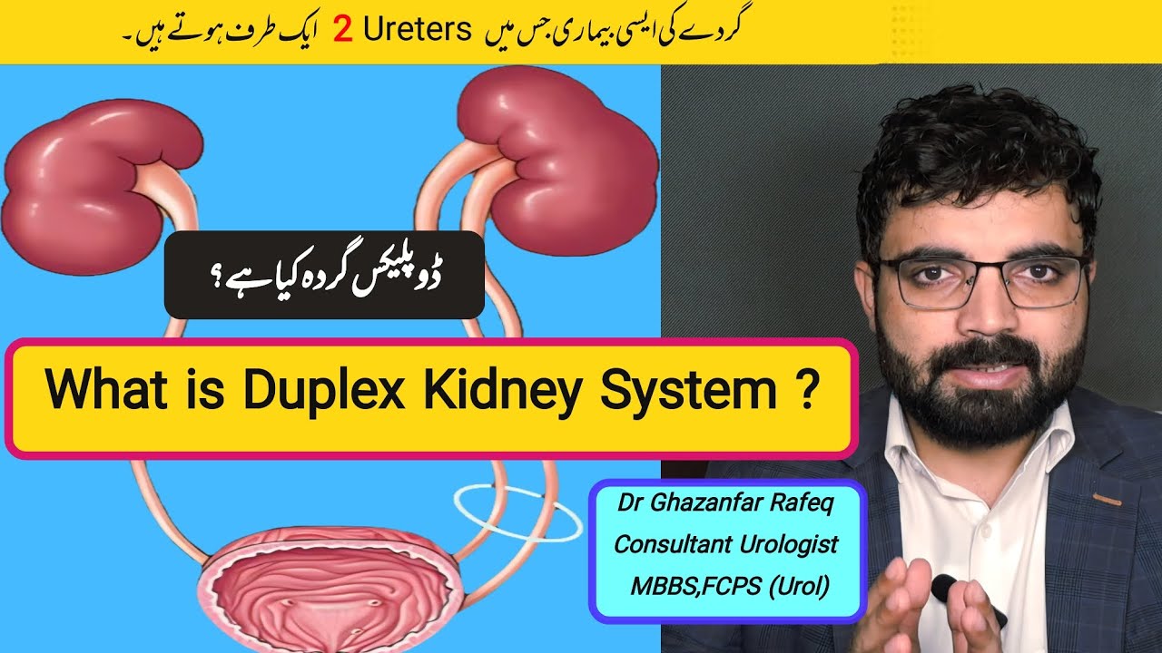 What is Duplex Kidney System ?|Urologist|Dr Ghazanfar #kidney #kidneydisease #kidneydiseasesymptoms 