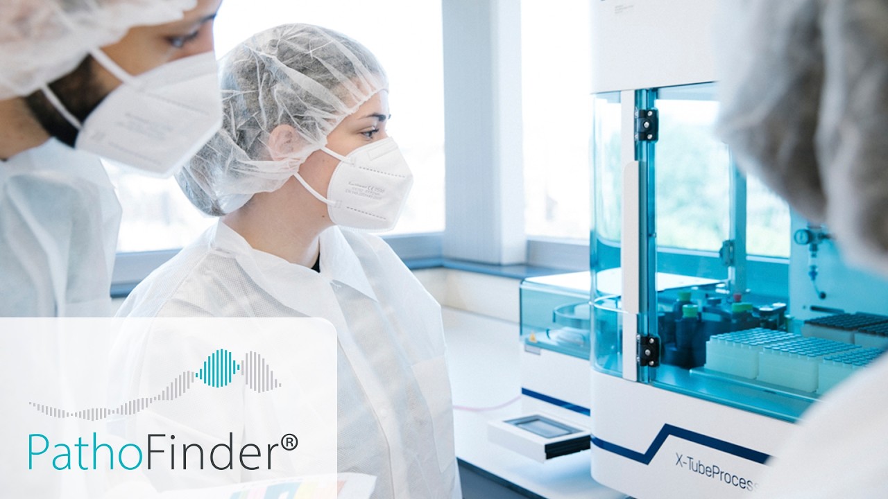 PathoFinder Case Study – Scaling Molecular Diagnostics with HTI Automation