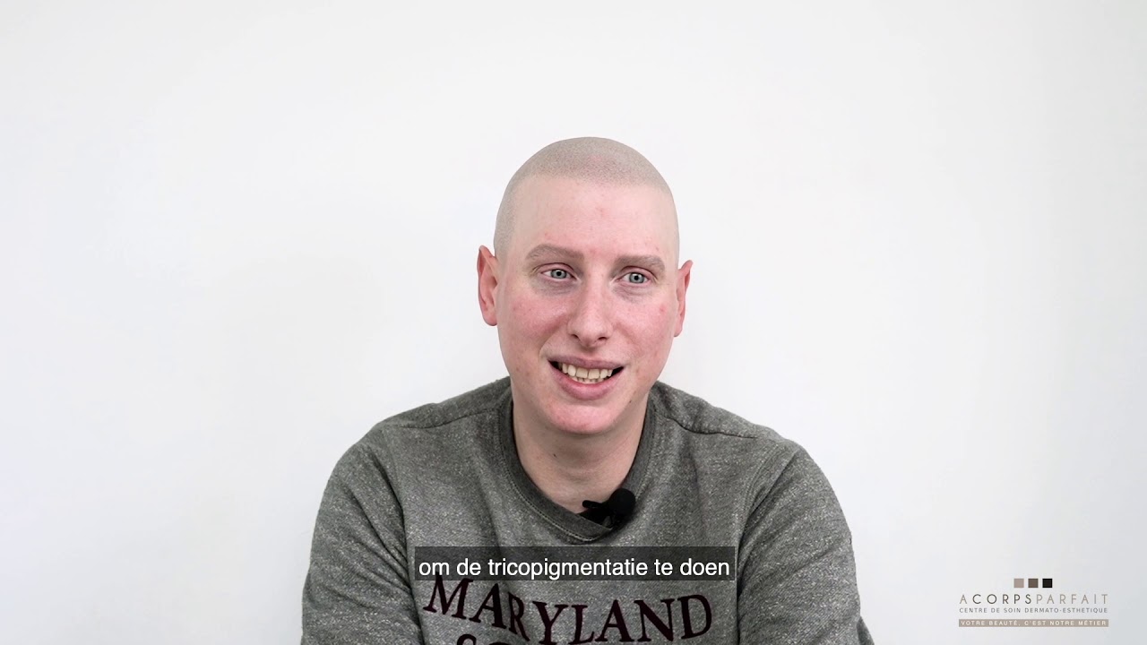 Morgan deelt zijn ervaring met universele met zijn alopecia universalis.(Nerderlands Ondertitel)