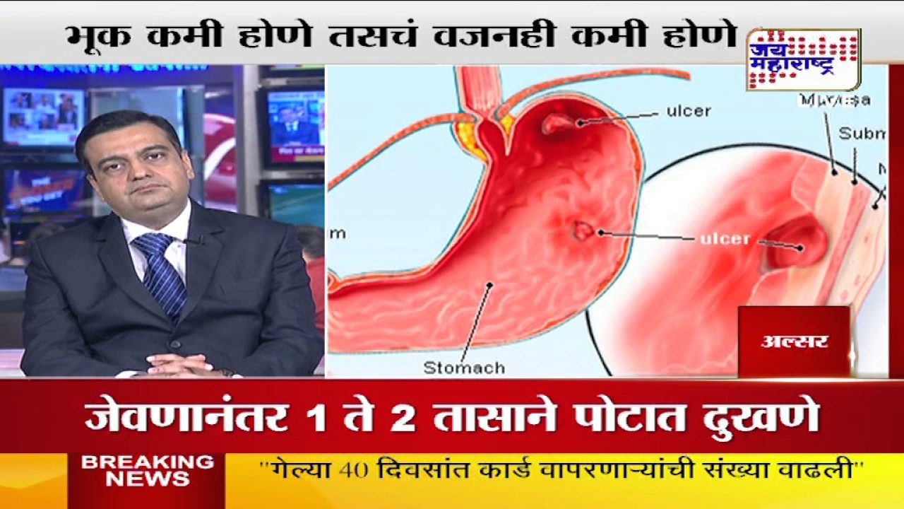 Lifeline:  How to cure Ulcer?