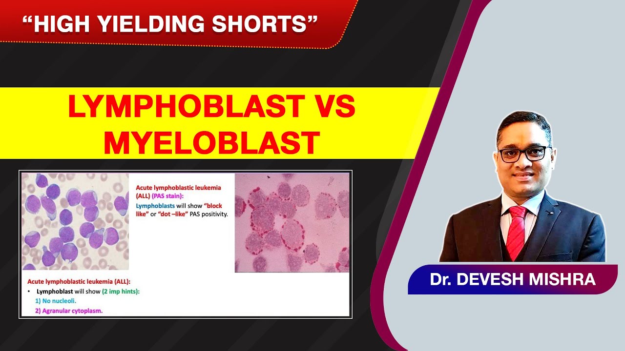 High Yielding Shorts-101 (#HYS-101): Lymphoblast vs Myeloblast by Dr Devesh Mishra.
