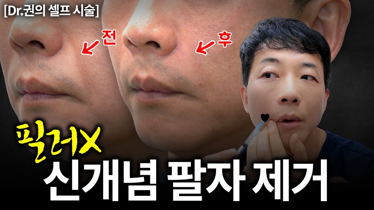 직접 보여드립니다. 마취없이 당일에 끝나는 신개념 포레스트 리프팅 | 리프팅, 주름, 유지인대 | 라인만드는 의사 권병소