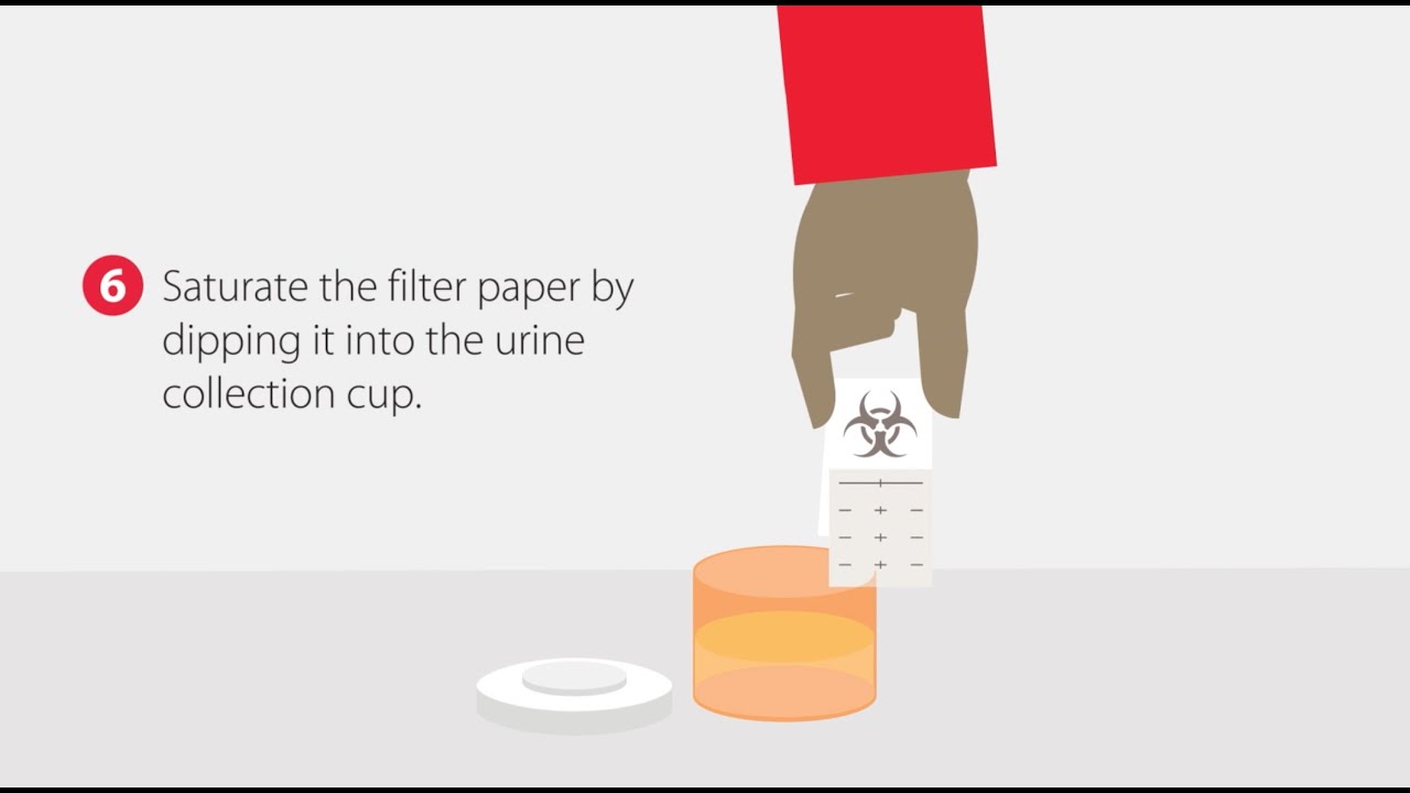 How to Collect a Dried Urine Sample | Step-by-Step Guide