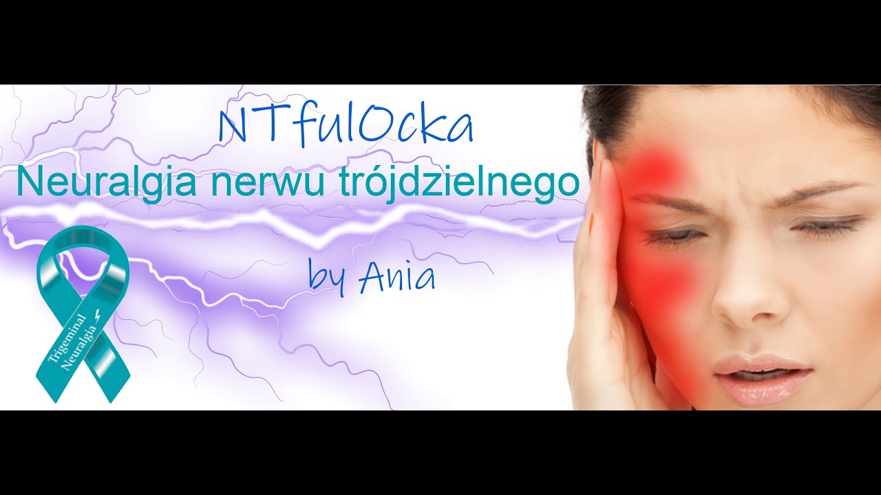 Neuralgia nerwu trójdzielnego - Moja historia
