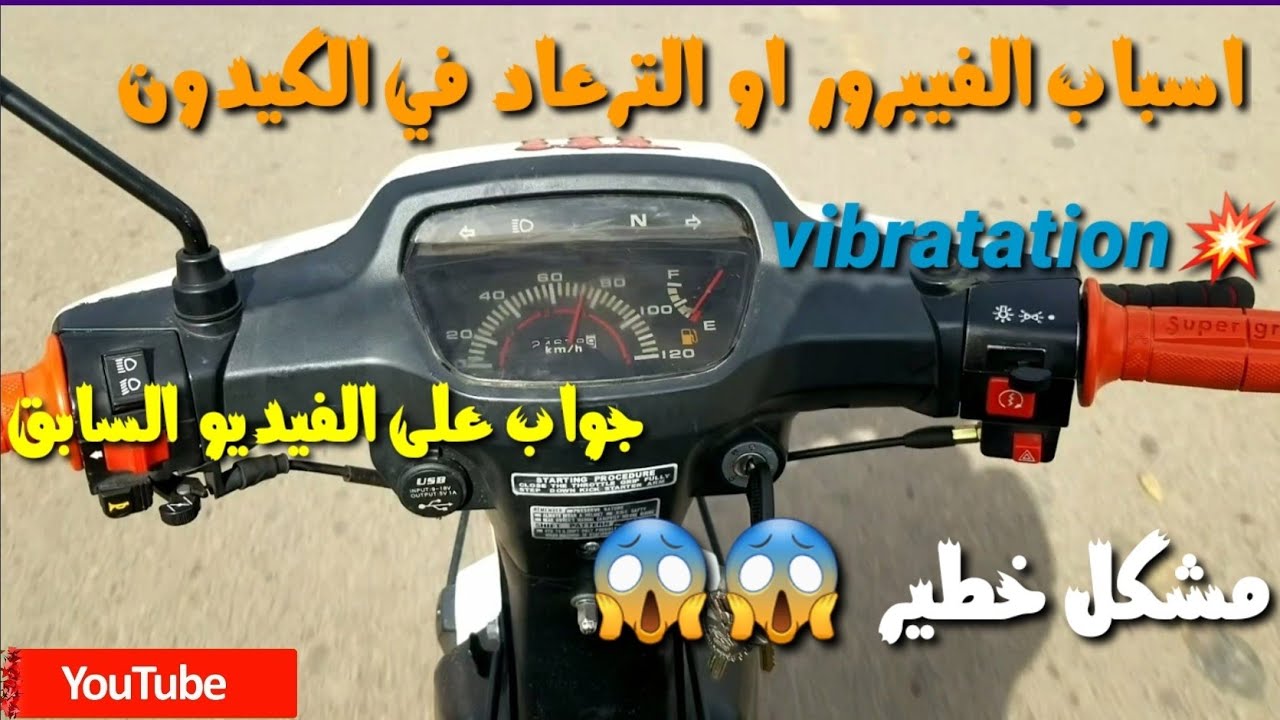 جميع اسباب الترعاد او الفيبرور  في الكيدون🤔🤔( فيديو يستحق المشاهدة )تتمة الفيديو السابق