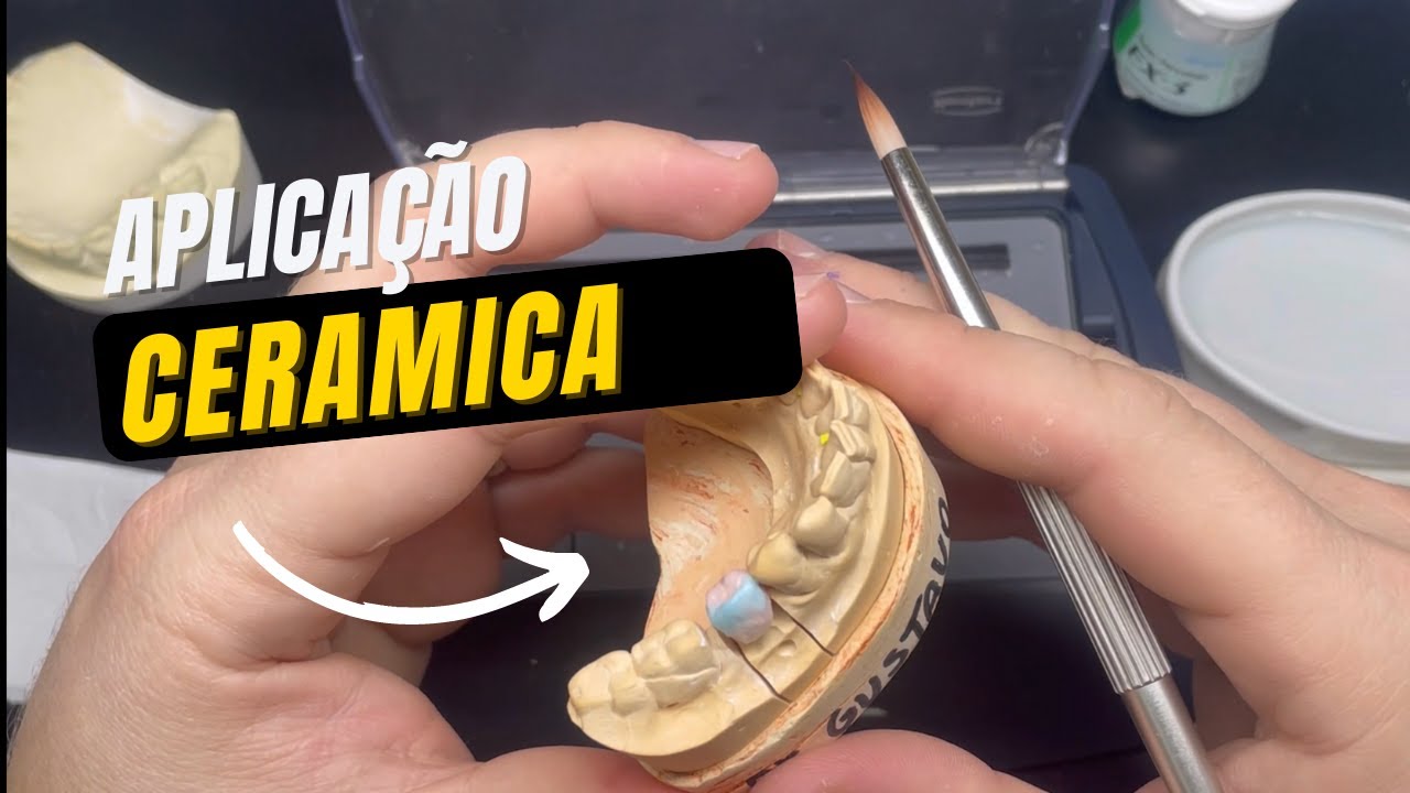 Aplicação de Cerâmica sobre Metal