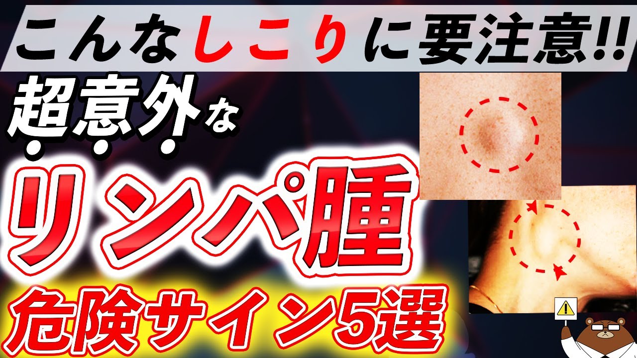 体にこんな「しこり」があったら絶対見逃さないで！悪性リンパ腫は「寝汗」でわかる？日本で一番多い血液がんの正体とは。初期の危険サインとは？医師が徹底解説！
