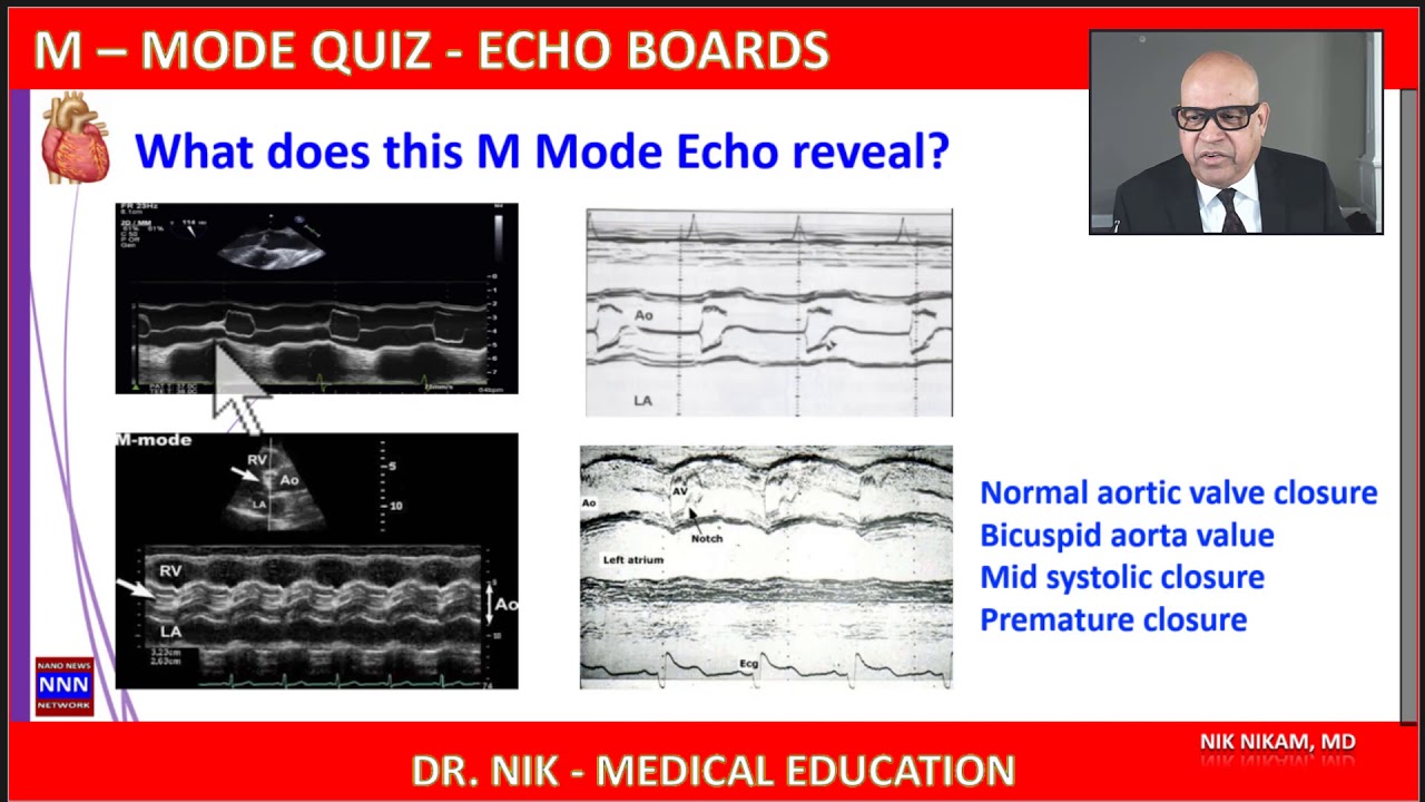 M Mode Quiz Echo Boards by NIK NIKAM MD