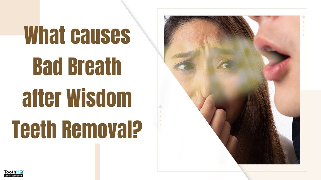 What causes Bad Breath after Wisdom Teeth Removal? How to treat? Dental Live Chat, Dr Vadivel DDS