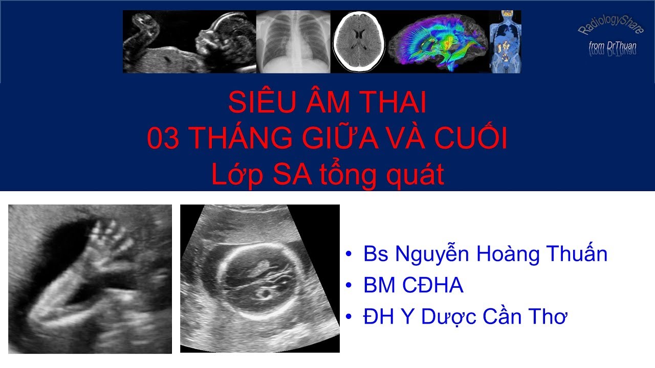 Siêu âm cơ bản 3 tháng giữa - cuối- phần 2- KHảo sát hình thái học
