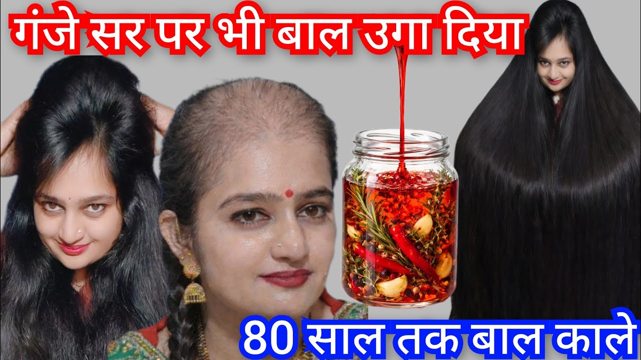 गंजा सर भी बालों से भर जाएगा👉नहाने जाने से 10 min पहले ये तेल लगाना बाल घुटनो तक लंबे🙈 HairGrowthOil