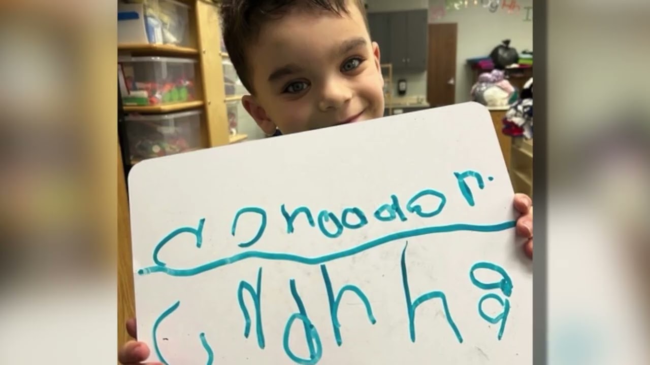 Riley patient taking 'exceptionally rare' condition in stride