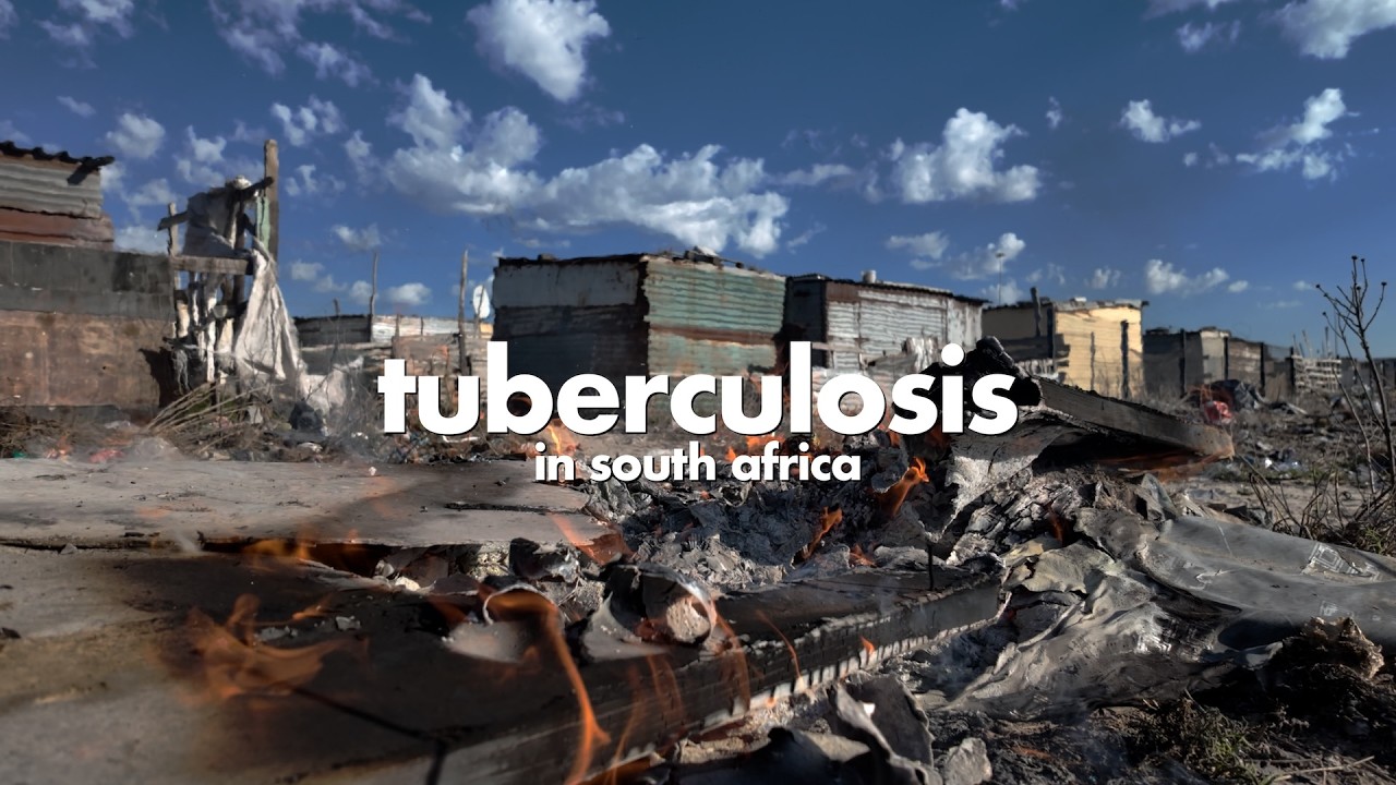 Tuberculosis in South Africa | A Silent Killer