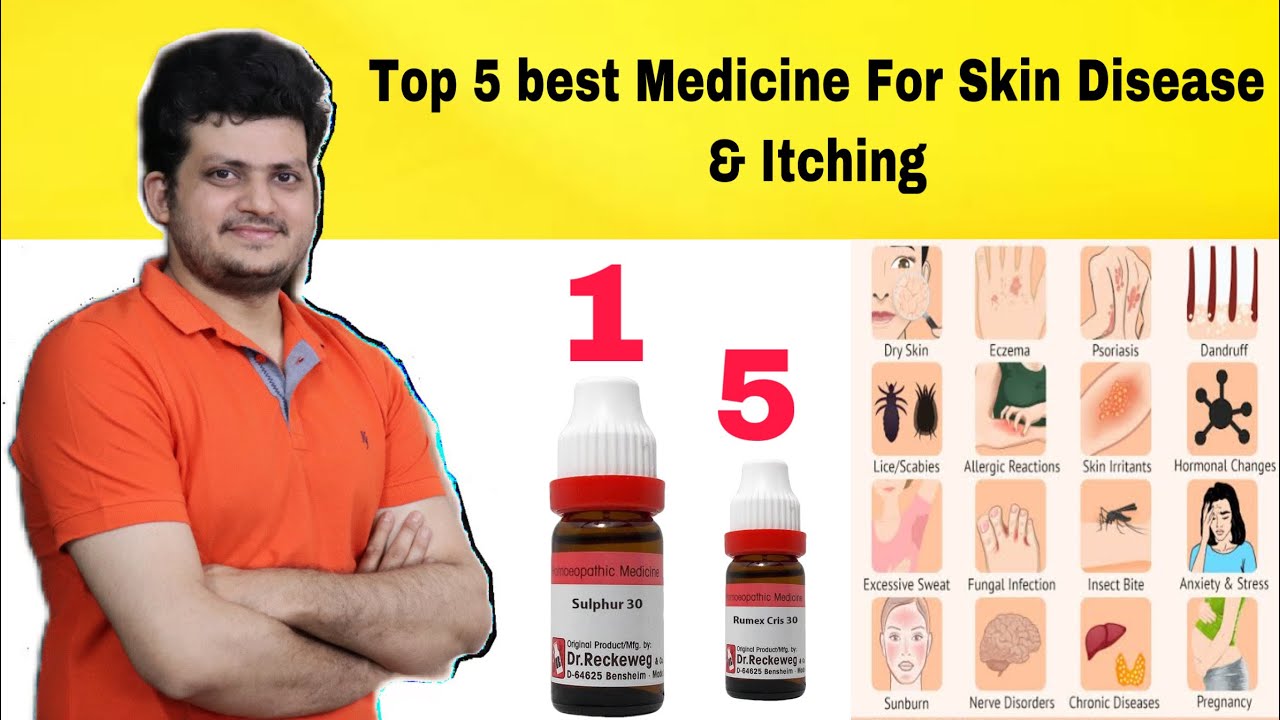 Top 5 Homeopathic Medicine for Itching & Skin Diseases ?