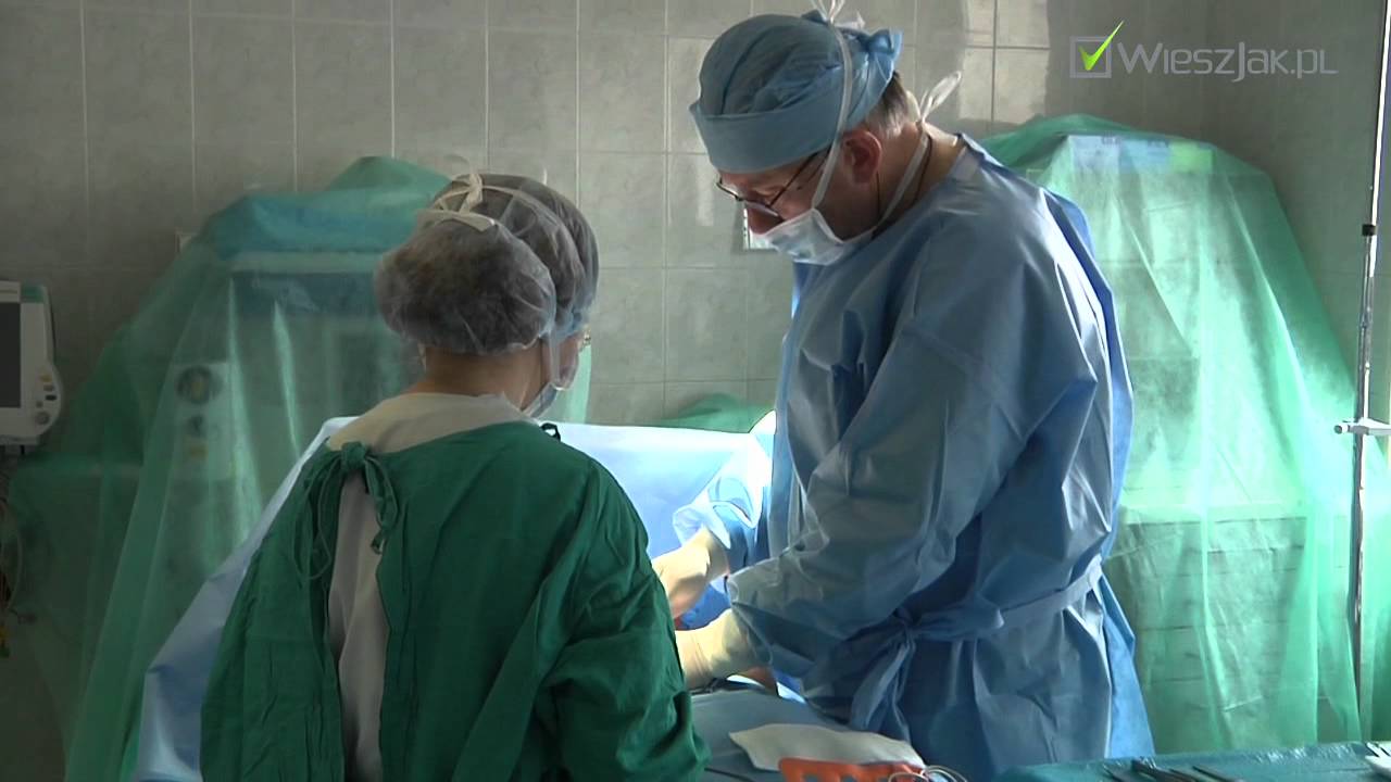 Czy liposukcja może zastąpić ćwiczenia fizyczne