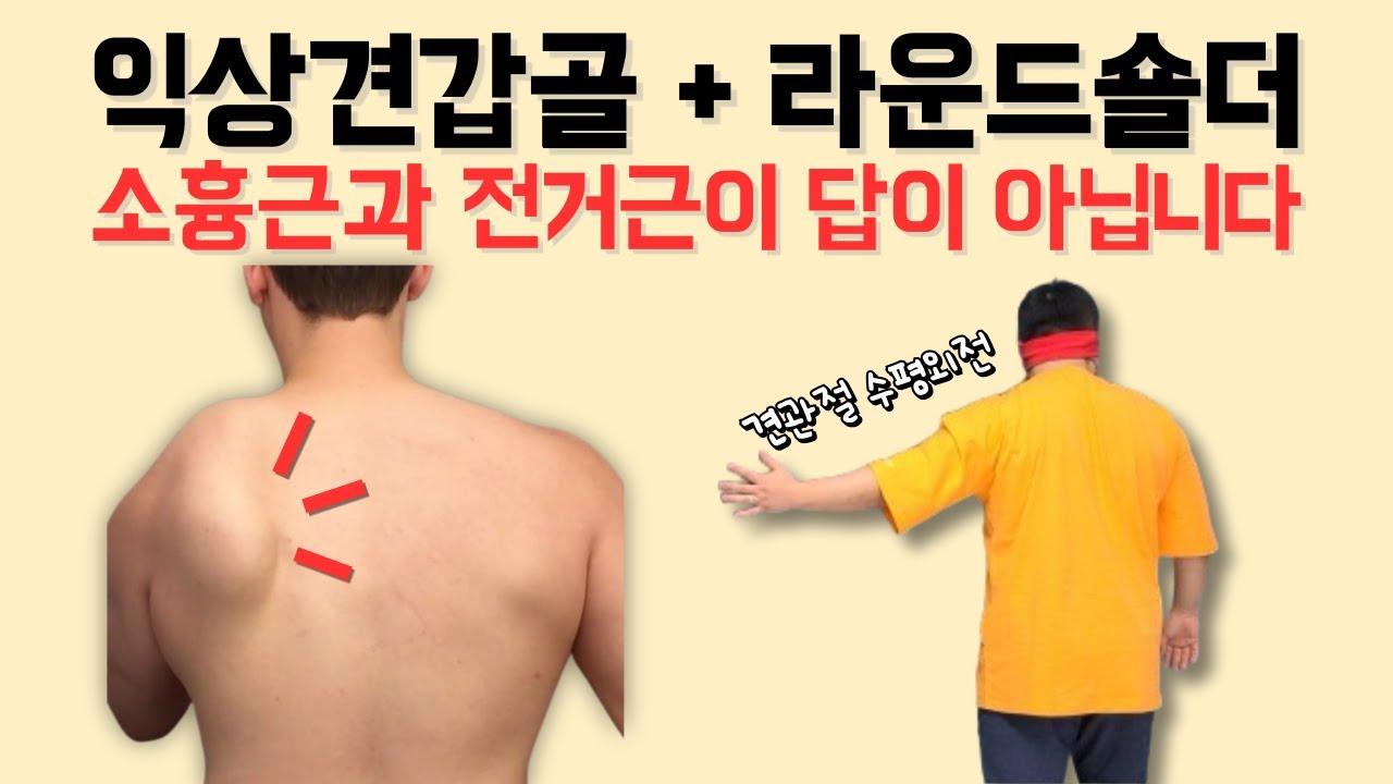 익상견갑골, 라운드숄더가 소흉근 스트레칭과 전거근 운동으로 해결이 될까요?