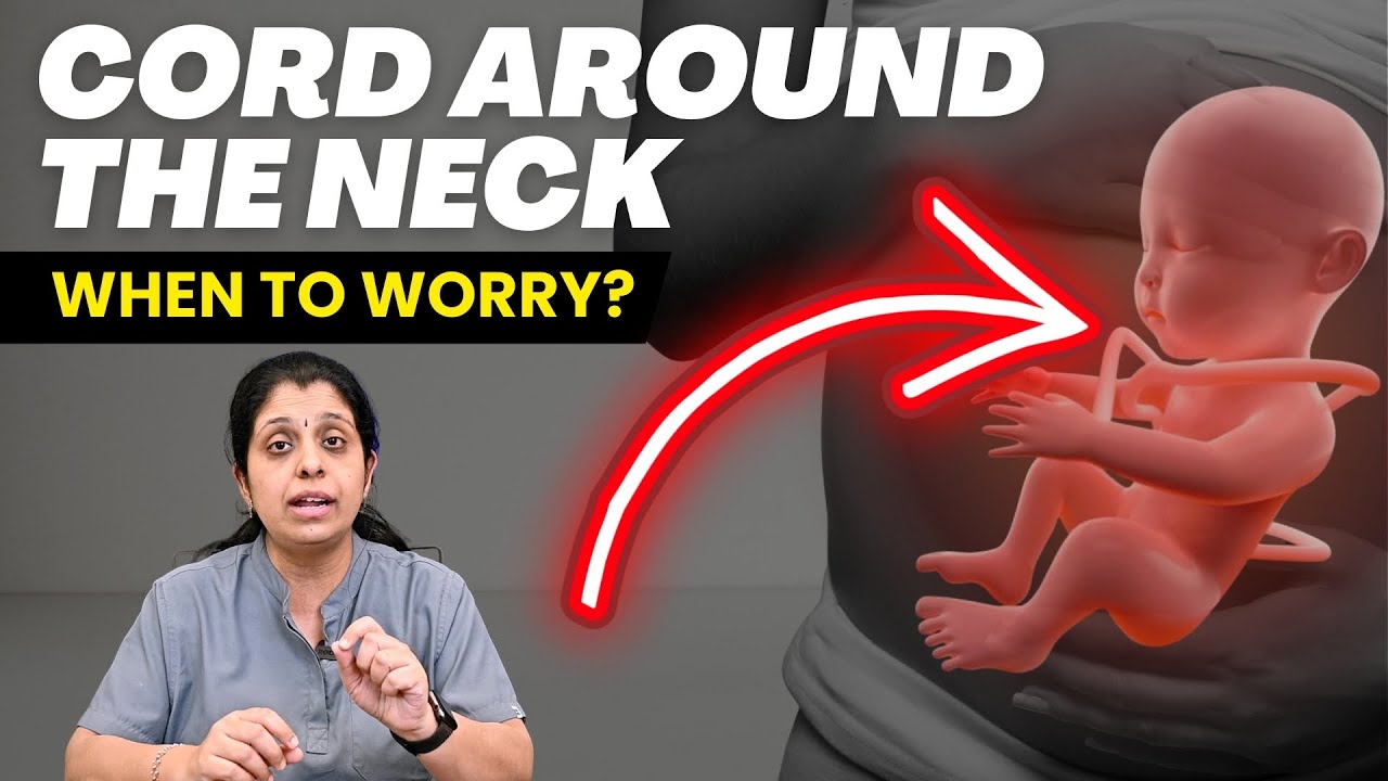 Cord Around Baby’s Neck: Delivery Facts | #drdeepthijammi