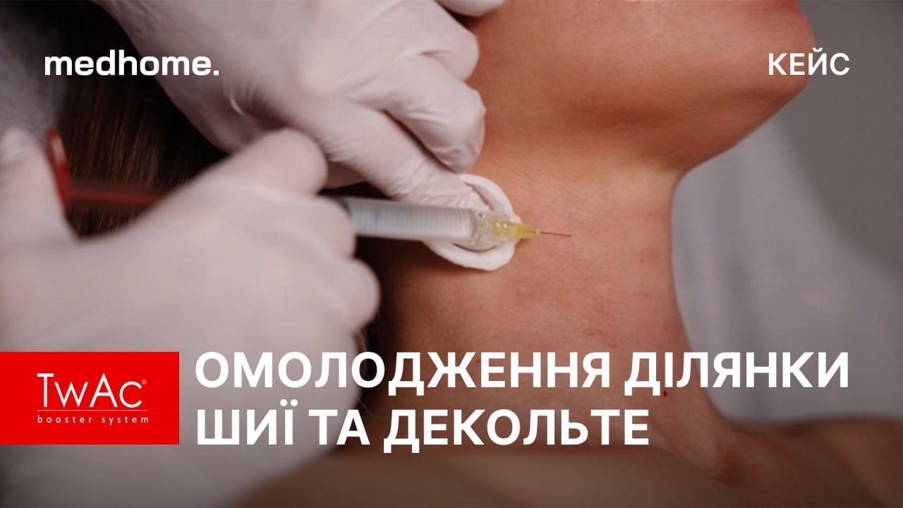 Комплексне омолодження шиї та декольте зі скін-бустером TwAc 2.0
