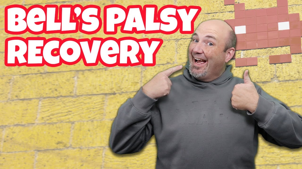 Recovery and Side Effects of Bells Palsy  - 1 Year Later