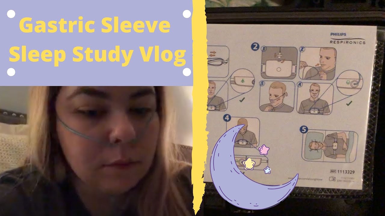 My Gastric Sleeve Sleep Study Experience
