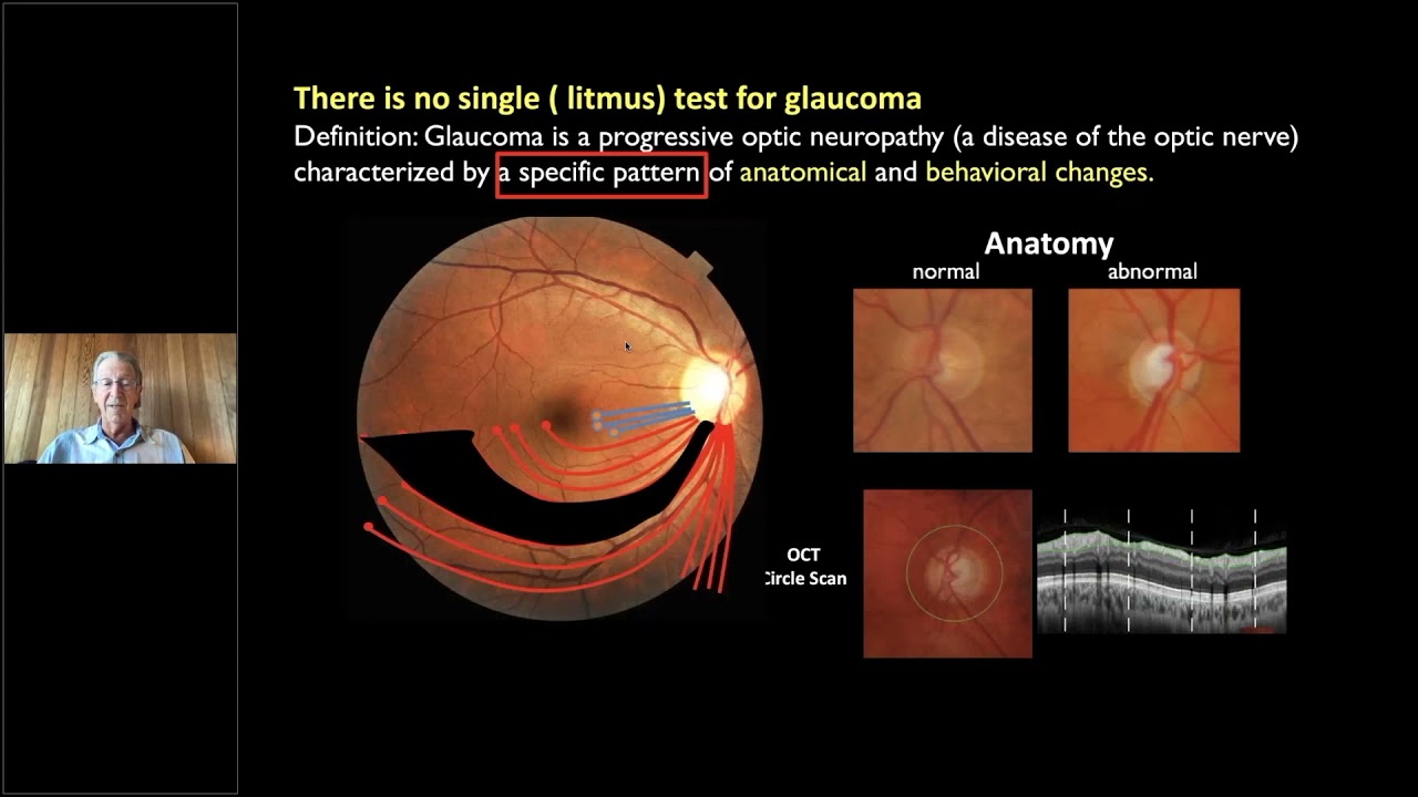 Recorded Webinar: An OCT Approach to Understanding & Diagnosing Glaucomatous Damage