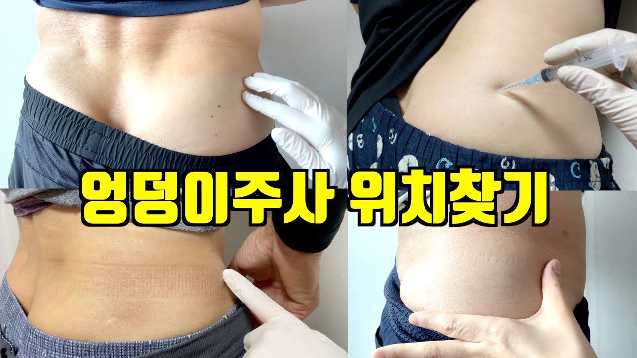 체형별 엉덩이 근육주사 위치 함께 찾아보기