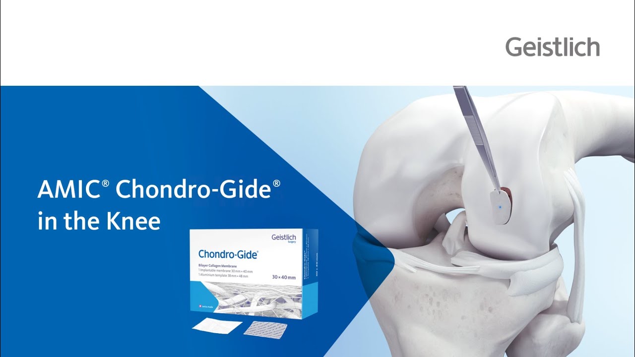 AMIC® Chondro-Gide® in the Knee