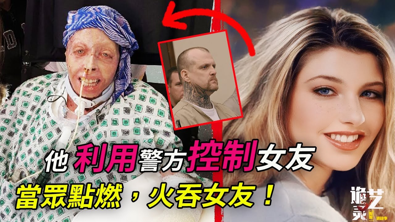男友點火後安靜觀賞她被燒过程，他曾報警30多次求保愛情；女人奇蹟存活，她留下了遺言，卻也是被判了“終身監禁” ——Judy Malinowski案詳細始末