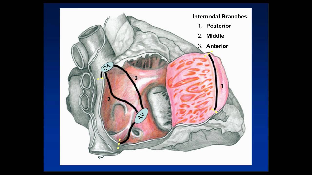 Cardiac CT: Anatomy and Anatomic Pitfalls Part 1