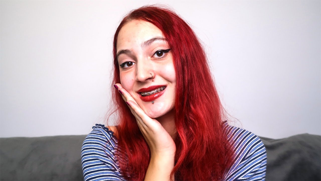 😬 MI-am pus APARAT DENTAR