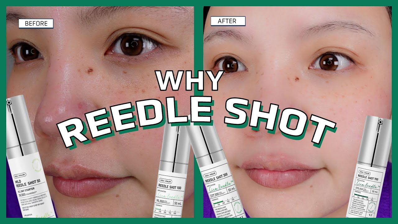 Your Ultimate Guide to Reedle Shot 🧪 | VT Cosmetics | HIKOCO