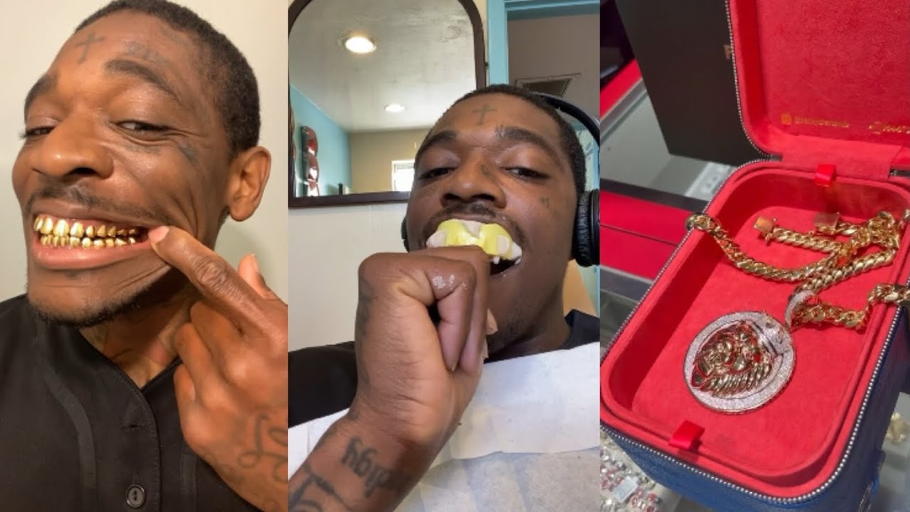 First Day Out Of Prison After Shopping Getting New 22k Permanent Grillz Teeth And Diamond Chain