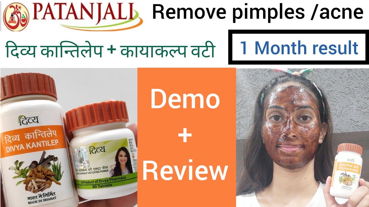 Remove acne/pimples || Patanjali divya kantilep & kayakalpvati - demo & review ||100% results