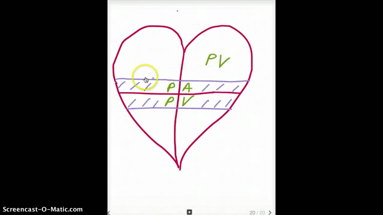Easy Ways to Remember Heart Embryology derivatives