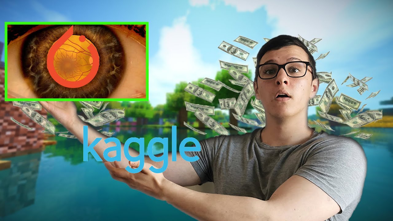 Detecting Eye Disease using Deep Learning | Kaggle Top 1% Solution, No Ensemble